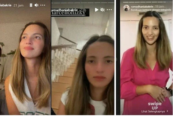 Mata dan pipi Nia Ramadhani sebelum ditangkap menjadi perhatian publik