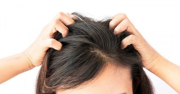 cara mengatasi kutu rambut
