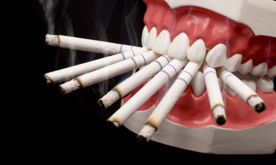 cara menghilangkan nikotin di gigi