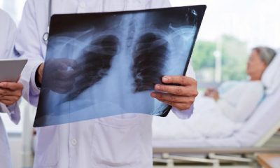 cara mengobati paru-paru basah