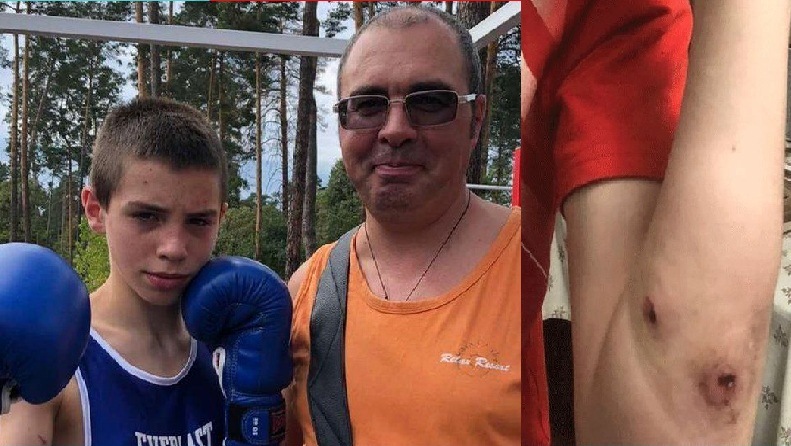 Remaja Ukraina Yuriy Nechyporenko dan ayahnya, Ruslan, serta lenganya yang luka akibat tembakan tentara Rusia