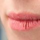 Tips Sederhana Mengatasi Bibir Kering Saat Berpuasa