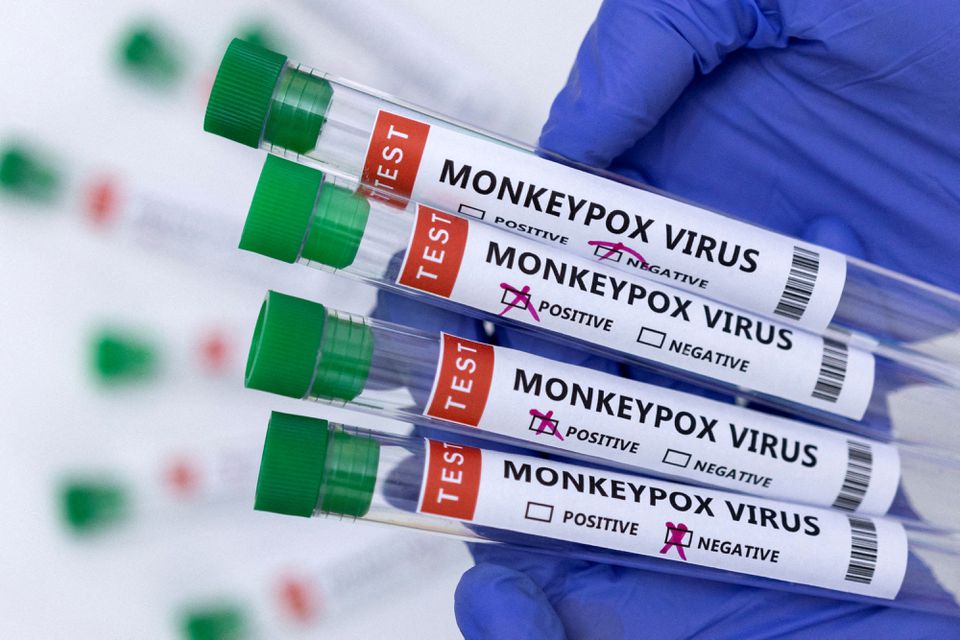 Hasil tes yang menunjukkan positif dan negatif terhadap virus Cacar Monyet