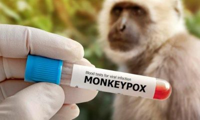 Indonesia belum ditemukan kasus cacar monyet