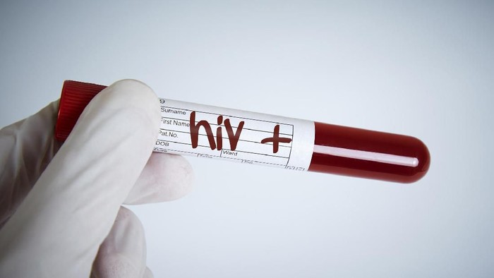 gejala awal hiv