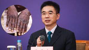 Komentar kepala ahli epidemiologi di Pusat Pengendalian dan Pencegahan Penyakit China (CDC) Wu Zunyou telah menimbulkan kontroversi
