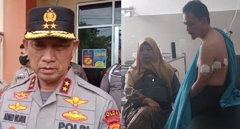 Kapolda Bengkulu Irjen Pol Armed Wijaya mengunjungi korban Rahiman Dani di rumah sakit Rafflesia Kota Bengkulu. 