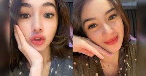 Masih Kurang Sempurna, Artis Angel Karamoy Melakukan Oplas di Korea Selatan Agar Lebih Sempurna