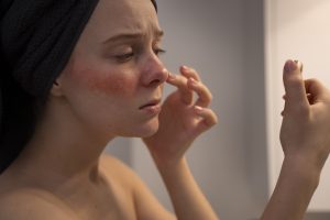 7 Kandungan Skincare untuk Kulit Sensitif, Aman dan Efektif!